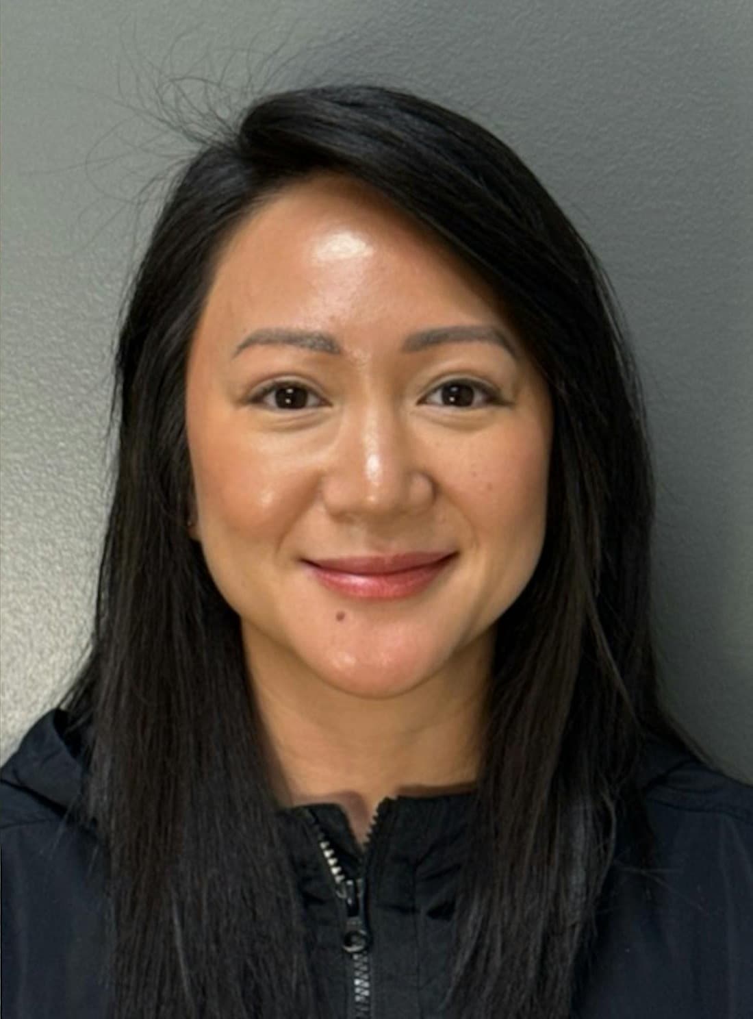 Blepharoplasty — After